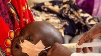 La crise alimentaire et la malnutrition mettent en danger de mort 8 millions d’enfants dans le monde

