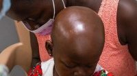 Diagnostic précoce du cancer chez l’enfant : l’exemple du Sénégal
