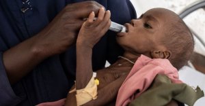 La faim dans le monde est concentrée dans seulement dix pays