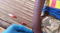 Mpox en Afrique : les enfants particulièrement menacés par la nouvelle variante
